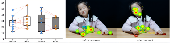 Improved active eye connect